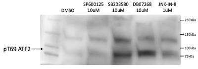 Western Blot: ATF2 [p Thr69] Antibody [NB100-81798]